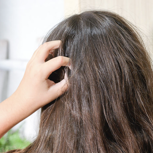 Champú sólido niños - Para prevenir los invasores